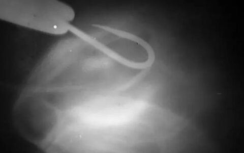 乌龟不小心吞入鱼钩和异物怎么办？