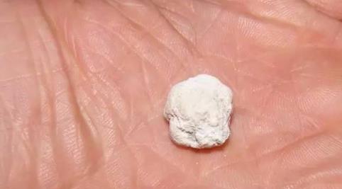 宠物乌龟结石该怎么办？（宠物乌龟结石的症状与治疗）