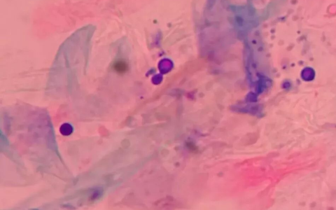 猫咪狗狗感染了马拉色菌怎么治疗？