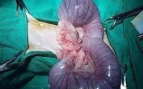 狗狗为什么会得子宫积脓症？