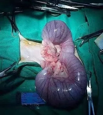 狗狗为什么会得子宫积脓症？